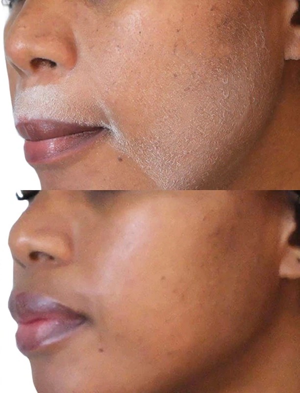 2024051718014918e1e.jpg اسپری مشخص کننده مو اسکین بادی - Sknbody - Image 7