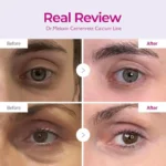 کرم دور چشم ترمیم کننده و جوانساز دکتر ملاکسین - Dr.Melaxin - Image 2