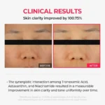 ماسک شب روشن کننده و ضد لک دکتر ملاکسین - Dr.Melaxin - Image 2