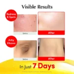 سرم ضد لک و روشن کننده اکوال بری - EQQUAL BERRY - Image 5
