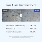 ماسک کنترل منافذ و جوش سر سیاه مدی کیوب - medicube - Image 2