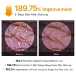 اسپری پیل شات لایه بردار و ضد لک کوجیک اسید دکتر ملاکسین - Dr.Melaxin - Image 3
