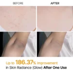 اسپری پیل شات لایه بردار و ضد لک کوجیک اسید دکتر ملاکسین - Dr.Melaxin - Image 2